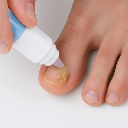 Hur använder man Nalox?