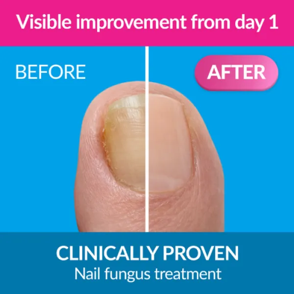 Nalox FORTE 30 ml